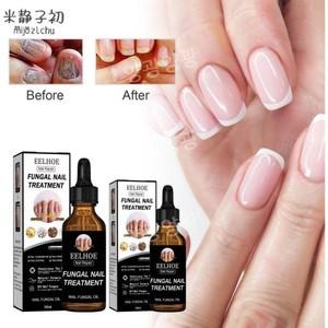 1+1+1 조갑사상균증 개선 에센스 대용량 50ml 손톱 발톱 강화제 영양제 리페어