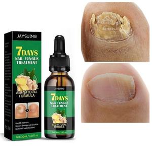 손발톱 치료제 진균 리페어에센스 케어제 발톱연화 관리 30ml 1개