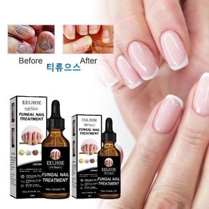 발냄새제거제 셀라큐어 조갑사상균 발톱무좀연고 손발톱무좀약 진균제