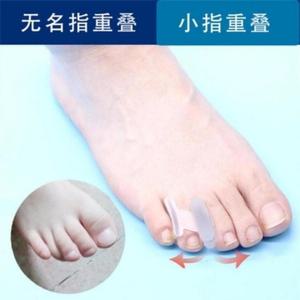 어른 네 번째 발가락 약지 발가락 교정기 아래 굴곡 중첩 변형되어 걸을 수 있습니다
