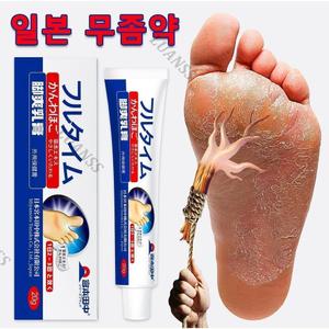 [당일배송] 무좀연고 로빠르고효과적인무좀제거발냄새발바닥가려움발에 땀이나고피부가