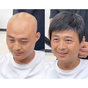 정수리 스포츠 중년 가발 짧은머리 대머리 남자 커버