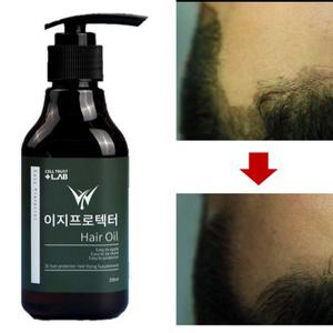 염색전 탈색 후 염색 두피 보호제 보습제 따가움 부작용 가려움 진물 곰팡이