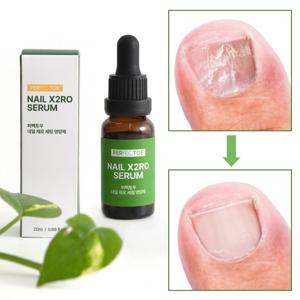 제로 문제성 발톱 영양제 손발톱 영양제 20ml