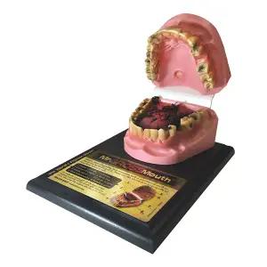 [HEALTH EDCO] 79152 - 흡연자의 구강모형