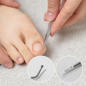 퍼펙토 2IN1 인그로운 발톱 큐렛 파고드는 발톱관리