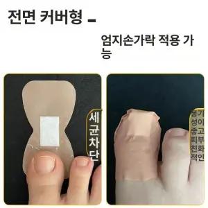 BINEL 발톱무좀밴드 집중케어 변색 밴드 곰팡이