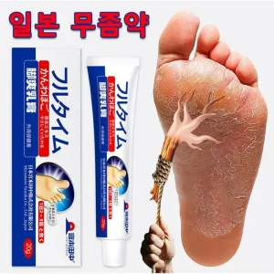 발바닥 발가락 가려움 완화  일본 발 연고 발냄새 제거 무좀연고 로빠르고효과적인무좀