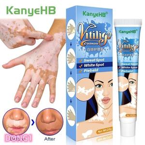 일본 수제 20g 초본 추출물 백반충 연고 백반점 제거 피부 백반증 질병 치료 크
