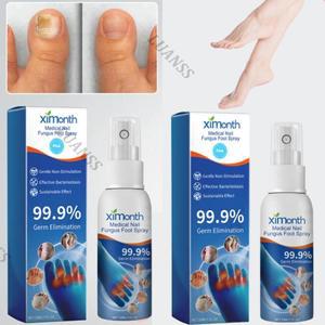 30ml+30ml 진균 제거 풋 스프레이 발톱 치료제 발가락 간지러움 발냄새 곰팡이균 발 관