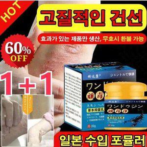 2개 일본 포뮬러 건선 고 헤어피부 의료 서비스제 피부 관련 질환연고 건선연고 냄새
