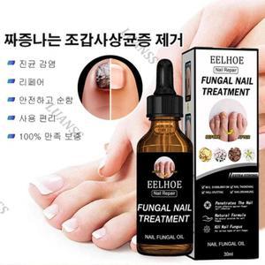 두껍ㄴ발톱 좀약 조갑사상균증 치료제 조갑사상균증리페어 에센스 q1 발톱좀 치료제[해