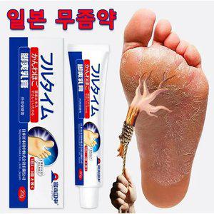 2개 무좀연고 로빠르고효과적인무좀제거발냄새발바닥가려움발에 땀이나고피부가벗겨지