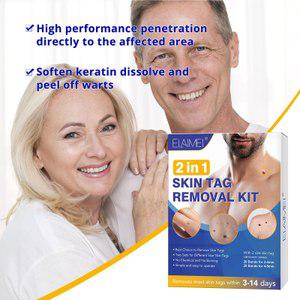 스킨 태그 리무버 장치 스킨 태그 제거 키트 Painless Tags  Moles Removal Pen 당신의 얼굴 목에 수리 플