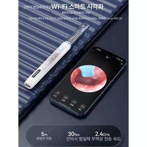 귀내시경 검이경 귀지제거 스마트 귀청소 내시경