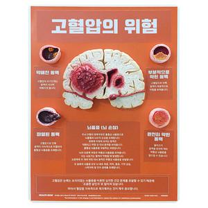 HEALTH EDCO 고혈압의 위험 모형 M79736KO