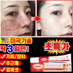 [당일발송] 1/1+1/2+2 기미 잡티 검버섯 주근깨 제거 크림 멜라토닝 멜라논 크림 들깨기미크림 화이트닝 스팟 크림 색소침착 얼국 미백 포장증정