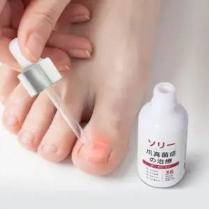 바르는 발톱 문제성 손발톱 약 진균 제거제 50ml