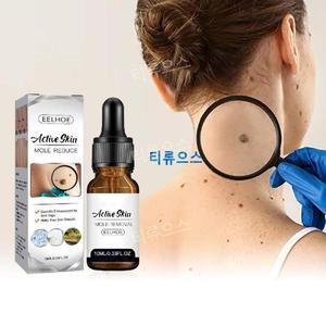 사마귀제거약/사마귀발바닥/티눈제거연고/물사마귀/얼굴기미약