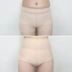 STK113 복부압박스타킹 압박스타킹 보정스타킹