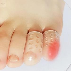 상상실현소 발가락보호 실리콘 골무 새끼발가락실리콘교정기