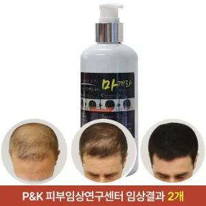 [마끼라] 남녀공용 두피영양 헤어토닉 300ml 프리미엄 탈모 완화 기능성 2개 세트