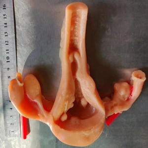 3D 생체 모방 모듈 복강경 전단 봉합 스트리핑 운동 시뮬레이션 자궁 실리콘