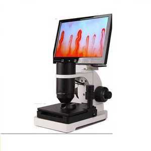 모세혈관 현미경 말초 혈류 혈관 고화질 속도 스크린