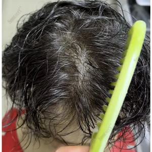 슈퍼 내추럴 헤어라인 80Density 0.02mm 울트라 씬 스킨 감지 불가능한 Vloop 남성용 가발 1b20 520 #   블랙 그레이 인모 가발