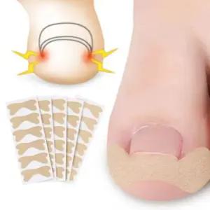 파고드는 내성 발톱 교정 보호 테이프 밴드 30pcs