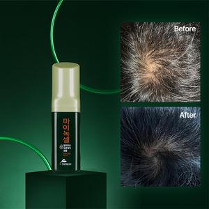 현대약품 마이녹셀 스칼프 인텐시브 탈모 앰플 60ml 1개 (소비자가 32,000원)