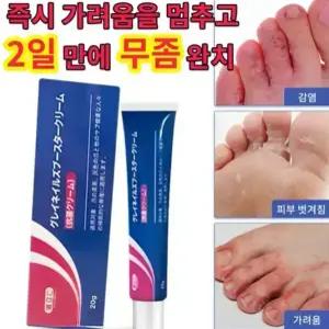 [일본 제품] 발바닥 발가락 가려움 완화 연고 일본 발 연고 발냄새 제거
