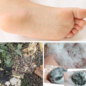 발비누+발각질제거+풋케어+발냄새제거제 / 문제성발 목초액 붉나무 천연비누/ 발샴푸 풋샴푸 발각질