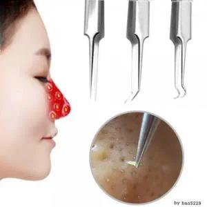 피지제거기 여드름짜기 코 얼굴 블랙헤드 압출 바늘