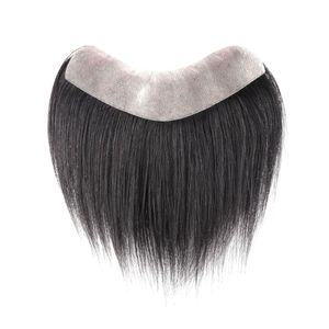 남성 스킨가발 앞머리 가발 넓은이마 붙이는 부분 커버