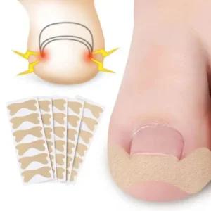 파고드는 내성 발톱 교정 보호 테이프 밴드 30pcs