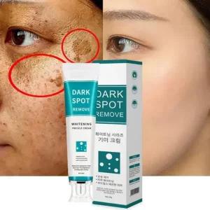 기미크림 기미·잡티·주근깨·검버섯 완화 크림 / 멜라닌 생성억해 / 색소침착 집중 케어