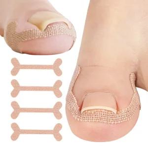 [12개입]내성발톱 교정 스티커