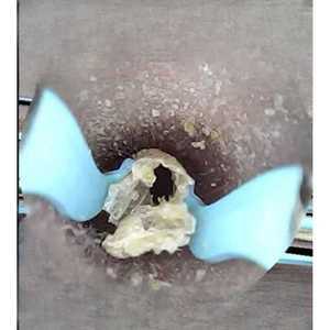 마카사조 내시경귀이개 귀내시경 귀이개 귀파개 귀청소 귀지제거 귀청소기 귀후비개 집게 핀셋귀지집게 귓