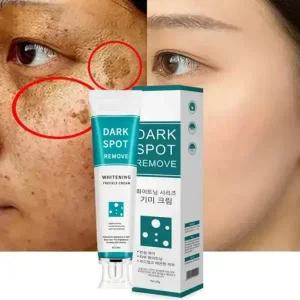 기미·잡티 고민 케어 크림 / 맑고 균일한 피부 톤 연출 / 피부 집중 정돈 케어 ,1개