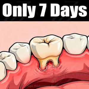 Eᴀsɪʟʏ ʀᴇɢᴇɴᴇʀᴀᴛᴇ ɢᴜᴍs ᴀɴᴅ ᴄᴏᴠᴇʀ ᴛᴇᴇᴛʜ ɪɴ 7 ᴅᴀʏs