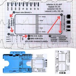 심전도 7단계 눈금자 투명 EKG 캘리퍼스 측정 휴대용 포켓 ECG 간호사 간편 휴대 눈금자 EKG 해석