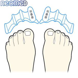 네오메드 발가락교정기 외출용 무지외반증 교정기
