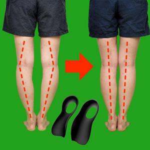 휜다리 팔자걸음 안짱다리 오다리 패드 자세 깔창