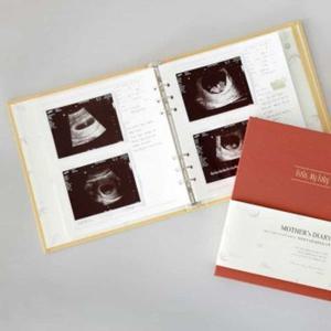 [하프클럽]임신일기 리필 앨범 초음파 사진 보관 태아 기록 다이어리