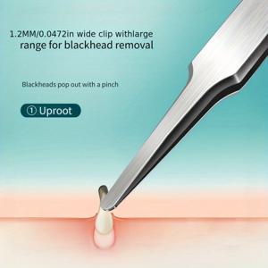 TEMU NILIYA 전문가용 정밀 여드름 제거기 & 블랙헤드 리무버 - 민감한 피부용 강력 그립 초박형 팁 핀셋, 눈썹/수염 제모, 통증 없는 블랙헤드 추출기, 미용실용 (1개)