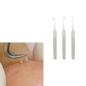 피지제거 집게 여드름 족집게 블랙헤드 추출 3종 세트