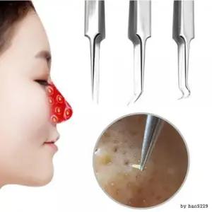 피지제거기 여드름짜기 코 얼굴 블랙헤드 압출 바늘