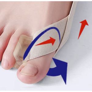새끼발가락휨 소지내반증 소건막류 신발 교정기 무지외반증 테이핑 교정기