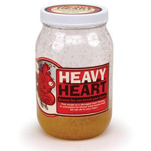 HEALTH EDCO 79699 - 비만이 심장에 미치는 영향 모형